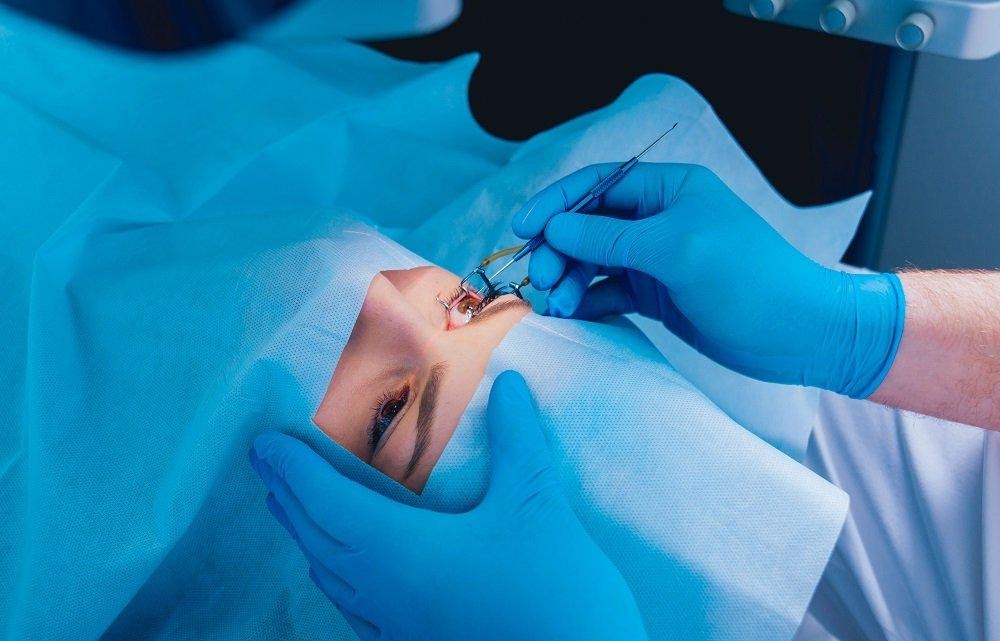 LASIK Surgery: Pros and Cons | Kraff Eye Institute